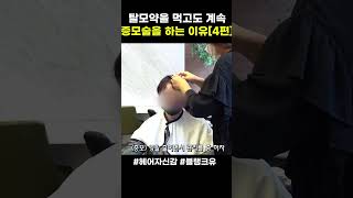 탈모약을 먹으면서 헤어증모술을 계속하는 이유 [4편]