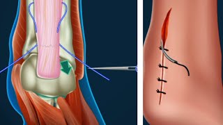 Asmr hand bone cracked and how to fix it #mrnajeebideas