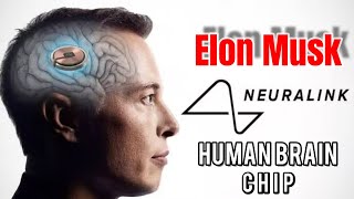 Brain computer interface: Elon Musk’s Neuralink Implants First Brain Chip in a Human