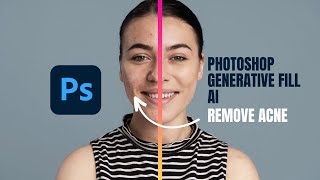 Remove Acne from face - Photoshop Generative Fill AI Tutorial