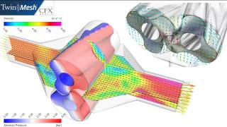 CFX Berlin-Video: Moving Mesh and CFD Results for a 3D Lobe Pump