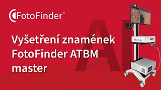 Vyšetření znamének - FotoFinder ATBM master - digitální dermatoskop