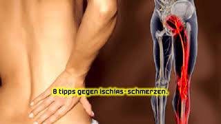 8 Tipps gegen Ischias-Schmerzen