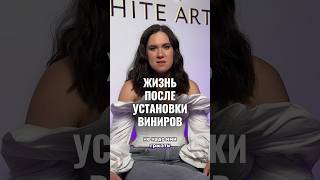 Жизнь после установки виниров - новое видео на канале #виниры