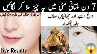 7 Day Skin whitening challenge with Multani Mitti |multani Matti FacePack | Skin Glowing Remedy amna