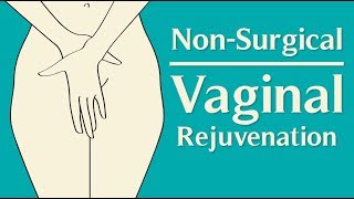 Non-Surgical Vaginal Rejuvenation