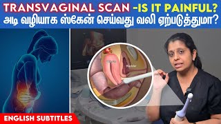 Is a transvaginal ultrasound painful | அடி வழியாக ஸ்கேன் செய்வது உண்மையில் வலி ஏற்படுத்துமா?