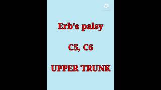 erb's palsy & klumpke's palsy trick