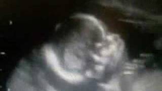 16week Ultrasound Scan