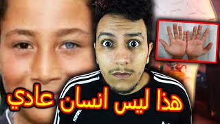 حقائق صادمة على الانسان الزهري