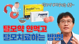 탈모약 부작용 있는 분들~~ 탈모약 안먹고 탈모치료하는 방법