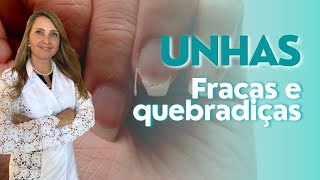 QUAL A CAUSA DAS UNHAS FRACAS - @draelizetekaffer