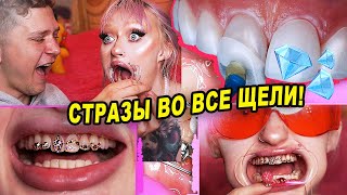 СТРАЗЫ НА ЗУБЫ ДОМА ( СКАЙСЫ) ПРИВЕТ, КАРИЕС! ЗУБКИ ТО ГНИЮТ...