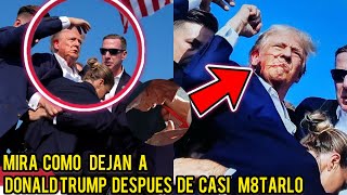 Mira como le quedo la cara a DONALD TRUMP luego de casi ser mu3rt9 Dios mío 💔😱