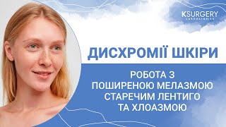 Дисхромії шкіри. Робота з поширеною мелазмою, старечим лентиго та хлоазмою.