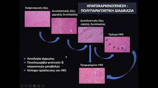 Κιρρωτικό Ήπαρ και ΗΚΚ - 4ο Κλινικο-απεικονιστικό σεμινάριο