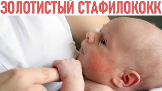 ЗОЛОТИСТЫЙ СТАФИЛОКОКК У МАЛЫШЕЙ | Симптомы Лечение Профилактика