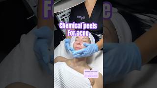 Chemical peels for acne at the Breslow Center for Plastic Surgery & Injxcellence Medical Spa Nj