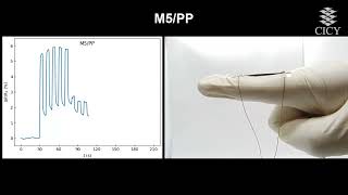 Detection of finger motion