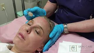 AquaGold at Skin Care Fort Worth