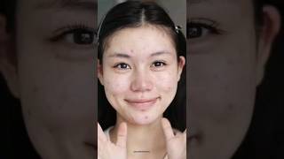 Without Filter Makeup Tutorial for acne skin 🌷🌼 Best makeup tutorial 💖