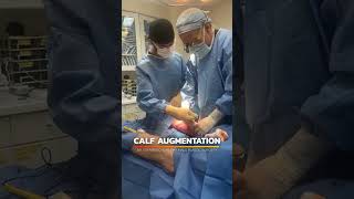 Calf Augmentation | Alpa Male Plastic Surgery #maleplasticsurgery