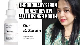 The Ordinary niacinamide 10%1 zinc Review after using three months,do,es and don't #theordinary