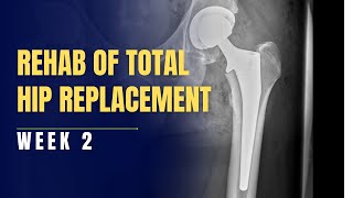 Rehabilitation of Bilateral Total Hip Replacement THR Week 2