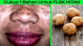 Satu-satunya Bahan Ampuh Untuk Menghilangkan FLEK HITAM & Bekas Jerawat