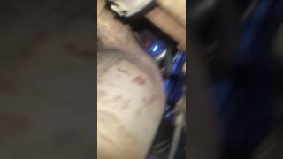 2.0 BKD Vag engine hissing sound