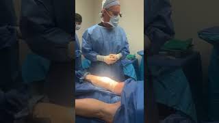 Calf Implants with Dr. Steinbrech | Alpha Male Plastic Surgery #maleplasticsurgery