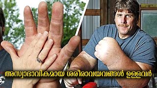 അസ്വാഭാവികമായ ശരീരാവയവങ്ങൾ ഉള്ളവർ | People with the Biggest body Parts