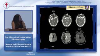 Manejo del Edema Cerebral, Implicaciones Anestésica, Dra. Mirna L. González Villavelazquez