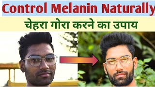 How to reduce melanin in skin naturally | Skin pigmentation treatment