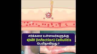 சர்க்கரை உள்ளவர்களுக்கு ஏன் Infection  Cellulitis பெரிதாகிறது ?Dr Sivaprakash