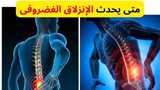 تعرف على أسباب وطرق علاج الإنزلاق الغضروفي _ وهل يمكن علاجه دون تدخل جراحى .