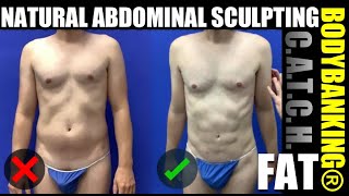 C.A.T.C.H Fat with Scarless Abdominal Sculpting | Male Plastic Surgery