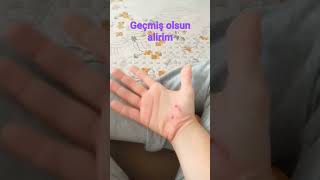 geçmiş olsun alirim