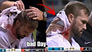 Bad Day in Baseball• Part1