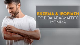 Έκζεμα, Ψωρίαση | Πως θα απαλλαγείτε μόνιμα