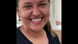 Facetas em Resina estética natural Antes X Depois + REAÇÃO