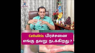 Cellulitis  பிரச்சனை எங்கு தவறு நடக்கிறது ?Dr Sivaprakash