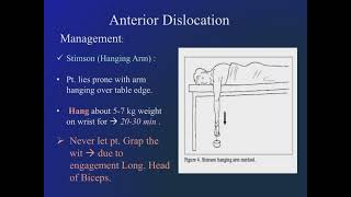 Treatment of anterior dislocation of shoulder