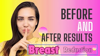 Before and after: Breast reduction surgery in Kandy. Call 0777 567 566