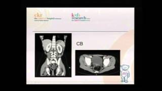 Urological Conditions (Kids Bladder Day 2015) - for medical professionals