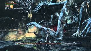 Bloodborne: Boss 16 - Amygdala