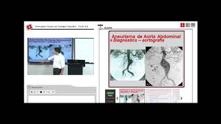 Cirurgia Vascular (Parte III)