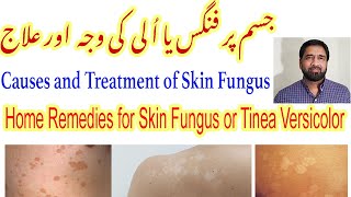 Fungal Skin Infection | Fungal Infection | Tinea Versicolor Treatment | Skin Fungus Yeast Infection