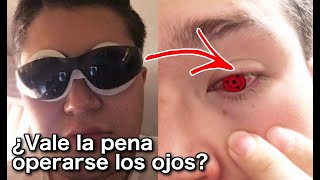 Ve este video antes de operarte los ojos | ¿Vale la pena operarte los ojos?