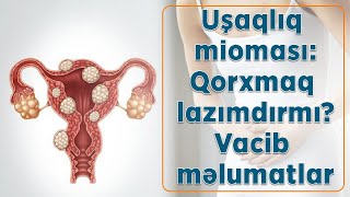 Uşaqlıq mioması: Qorxmaq lazımdırmı? Vacib məlumatlar